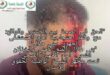 “الشبكة الوطنية لحقوق الإنسان تدين الاعتداء على طبيب مستعجلات بني ملال وتحمل المندوبية الجهوية مسؤولية الخصاص” تحت مجهر الشبكة الوطنية لحقوق الإنسان