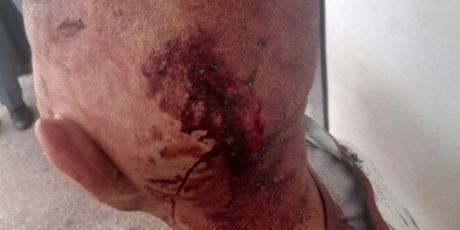 قصبة تادلة اعتداء خطير على شاب  بأولاد سعيد الواد اقليم بني ملال والجناة مازالوا احرارا